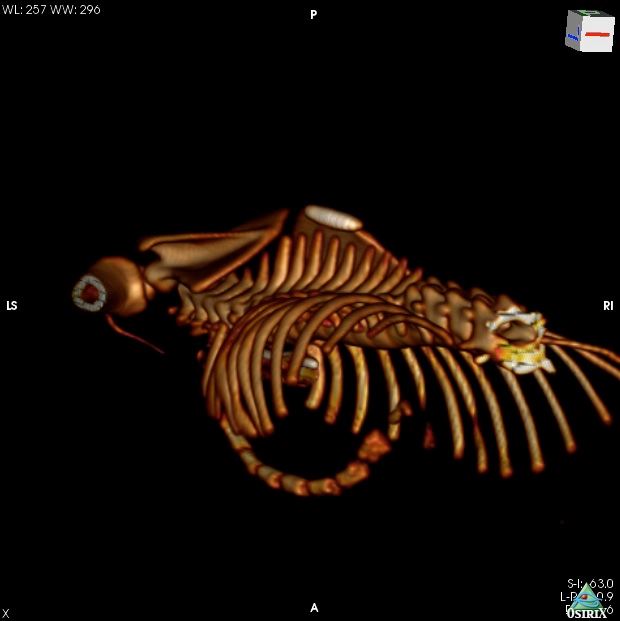 CTof Pectus Excatatum Kitten